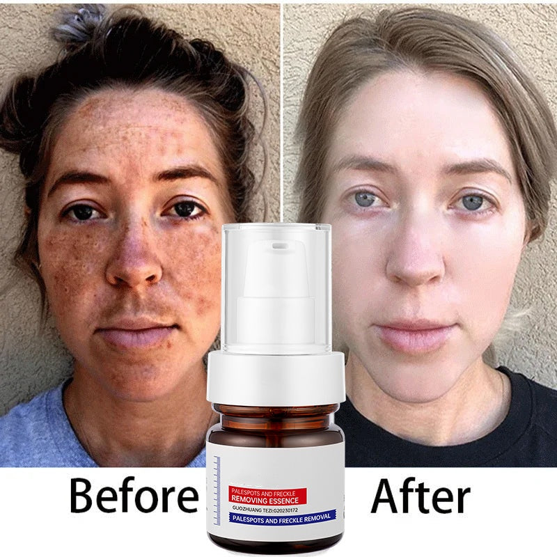 š„ FLASH SALE: SAVE 50%! Vitamin C Brightening Serum - Fast Dark Spot Corrector for Radiant Skin (3 HOURS LEFT!)