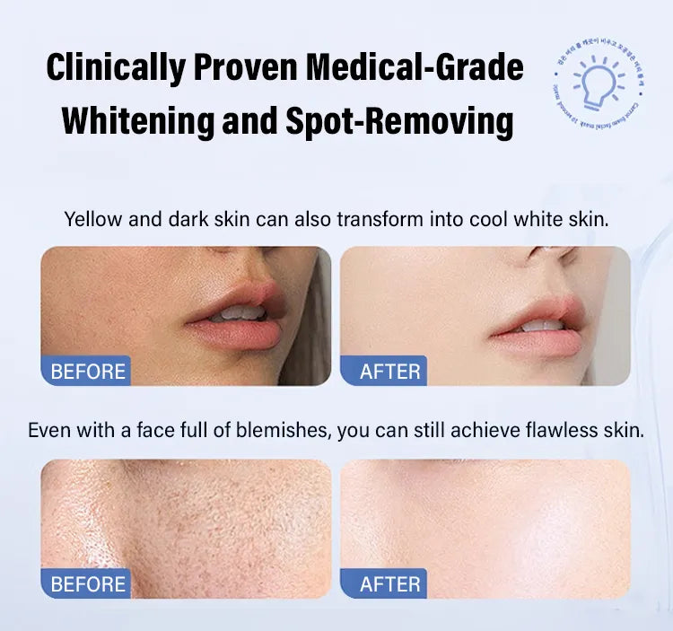 š„ FLASH SALE: SAVE 50%! Vitamin C Brightening Serum - Fast Dark Spot Corrector for Radiant Skin (3 HOURS LEFT!)