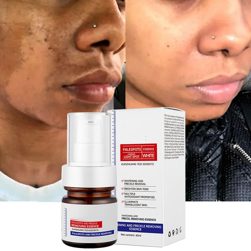 š„ FLASH SALE: SAVE 50%! Vitamin C Brightening Serum - Fast Dark Spot Corrector for Radiant Skin (3 HOURS LEFT!)