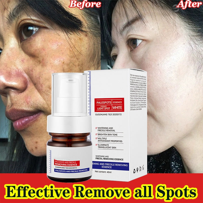 š„ FLASH SALE: SAVE 50%! Vitamin C Brightening Serum - Fast Dark Spot Corrector for Radiant Skin (3 HOURS LEFT!)