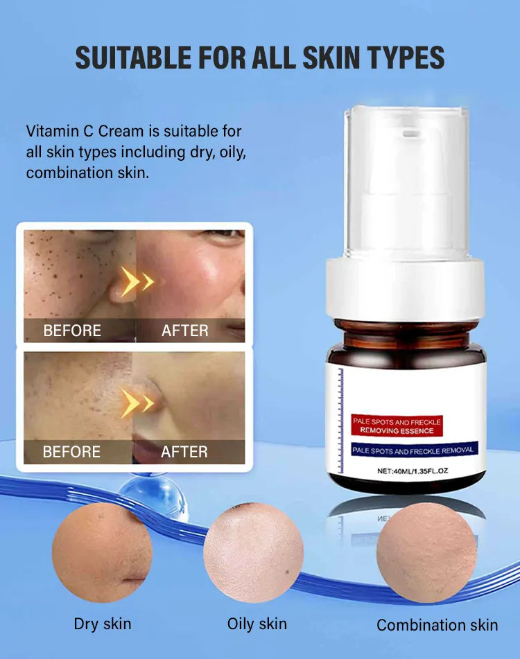 š„ FLASH SALE: SAVE 50%! Vitamin C Brightening Serum - Fast Dark Spot Corrector for Radiant Skin (3 HOURS LEFT!)
