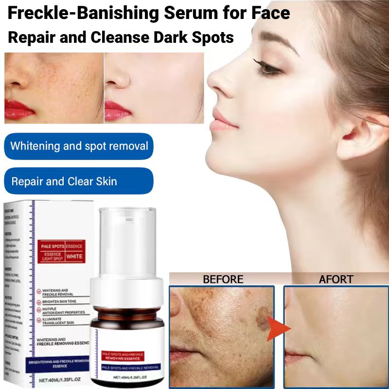 🔥 FLASH SALE: SAVE 50%! Vitamin C Brightening Serum - Fast Dark Spot Corrector for Radiant Skin (3 HOURS LEFT!)