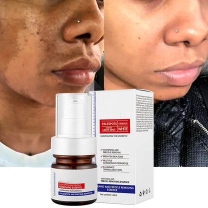 🔥 FLASH SALE: SAVE 50%! Vitamin C Brightening Serum - Fast Dark Spot Corrector for Radiant Skin (3 HOURS LEFT!)